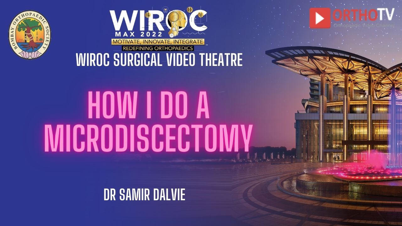 How I do a Microdiscectomy Dr Samir Dalvie