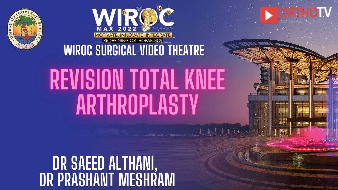Revision total knee arthroplasty Dr Saeed AlThani, Dr Prashant Meshram