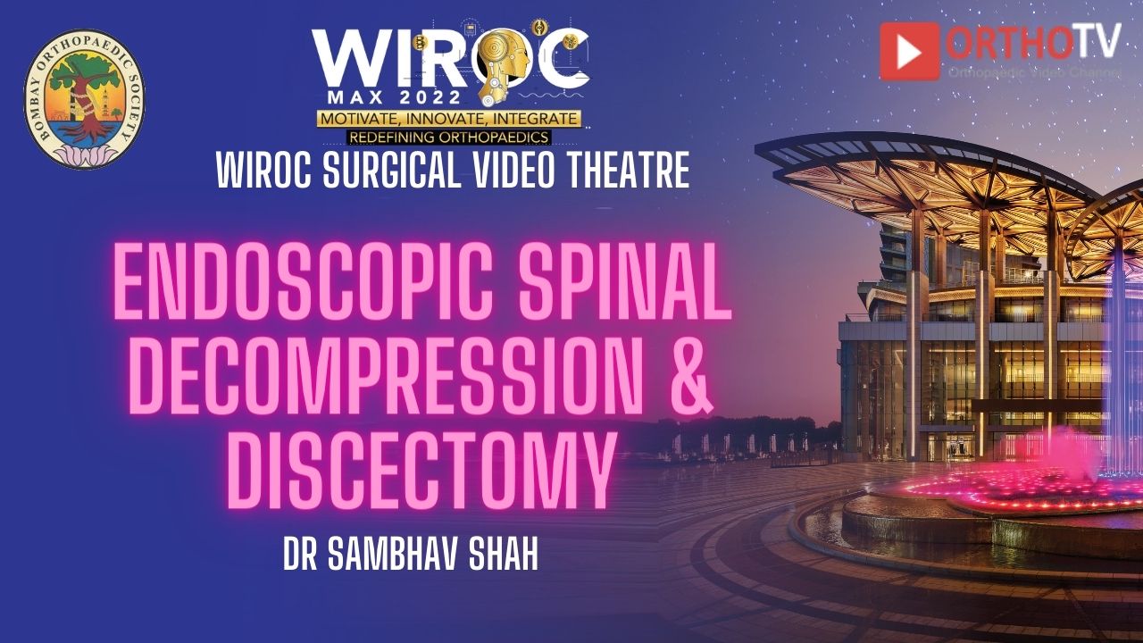 Endoscopic spinal decompression & discectomy Dr Sambhav Shah