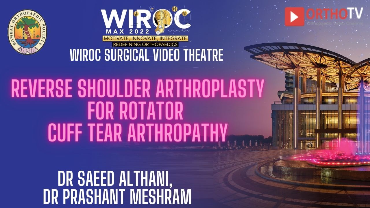 Reverse shoulder arthroplasty for rotator cuff tear arthropathy Dr Saeed AlThani, Dr Prashant Meshram