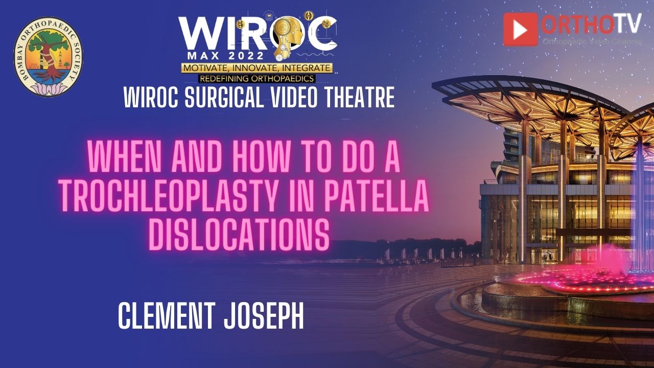 When and how to do a Trochleoplasty in Patella dislocations Dr Clement Joseph