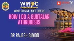 How I do a Subtalar athrodesis Dr Rajesh Simon