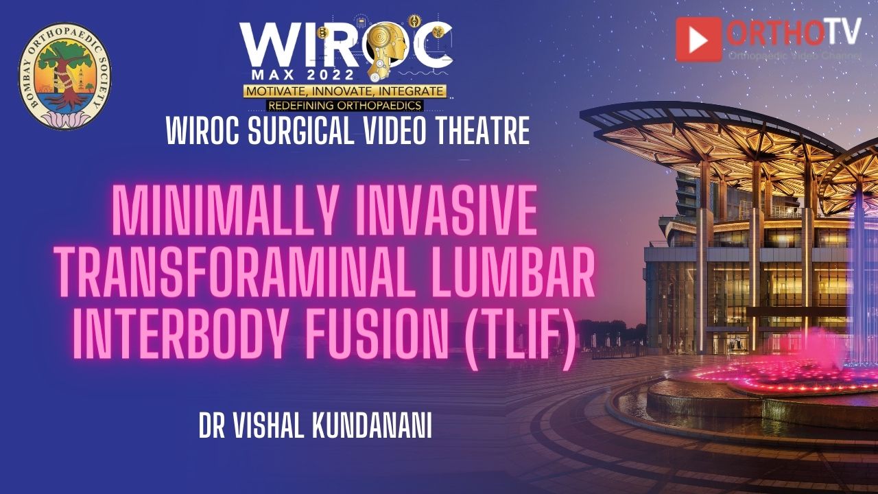 Minimally invasive Transforaminal Lumbar interbody fusion (TLIF) Dr Vishal Kundanani