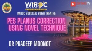 Pes Planus correction using novel technique Dr Pradeep Moonot