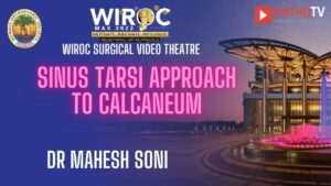Sinus Tarsi approach to calcaneum Dr Mahesh Soni
