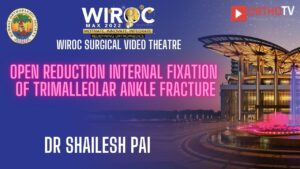 Open Reduction Internal Fixation of trimalleolar ankle fracture Dr Shailesh Pai