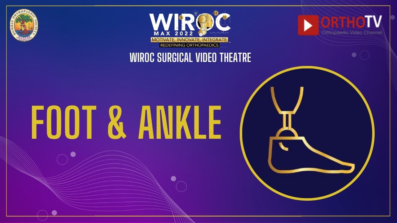 Foot & Ankle Surgery Videos : WIROC MAX SURGICAL Video Theatre