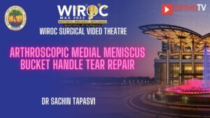 Arthroscopic Medial Meniscus Bucket Handle Tear Repair Dr Sachin Tapasvi