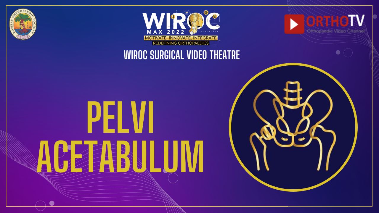Pelvis-Acetabulum Surgery Videos : WIROC MAX SURGICAL Video Theatre