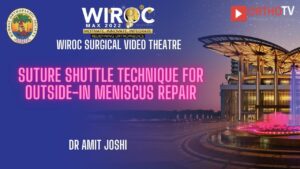 Suture Shuttle Technique for Outside-In Meniscus Repair