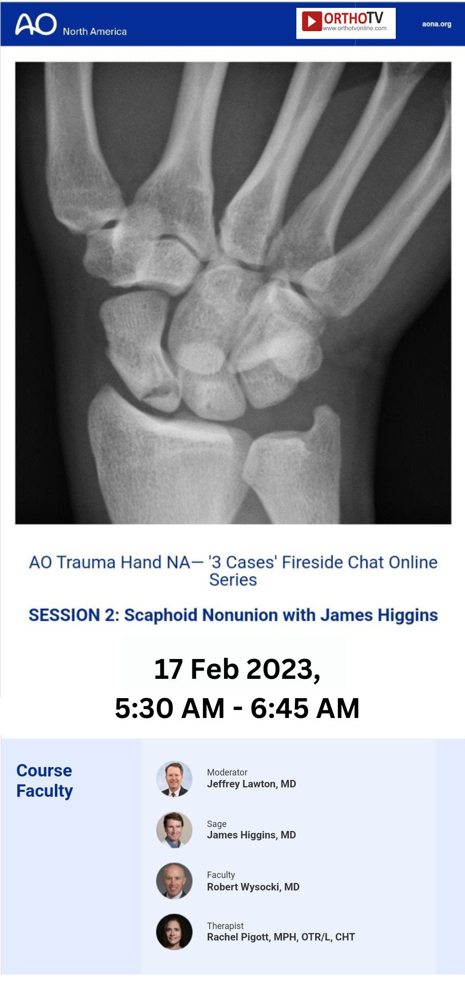 AO TRAUMA HAND NORTH AMERICA Webinar on OrthoTV Global - 3 Cases Fireside Chat Online Series - Session 2 : Scaphoid Nonunion with James Higgins