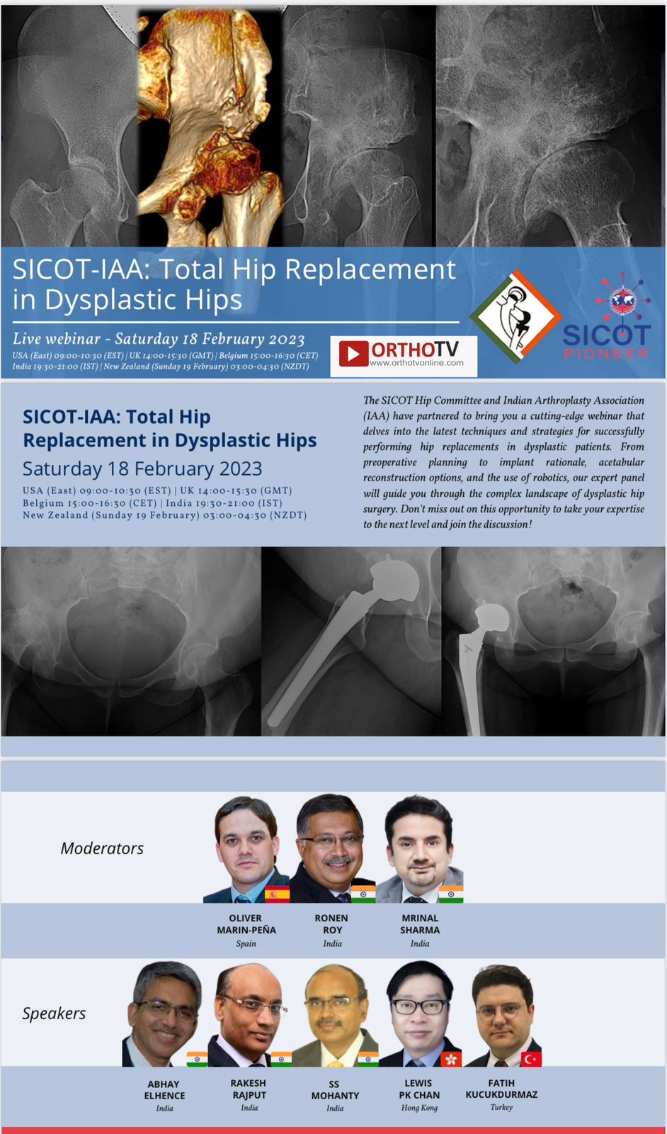 SICOT-IAA: Total Hip Replacement in Dysplastic Hips: Abhay elhence,Rakesh rajput