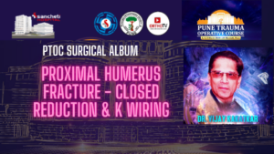 Proximal Humerus Fracture - Closed Reduction & K Wiring - Dr Vijay Kakatkar