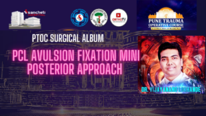 PCL Avulsion Fixation mini posterior approach by Dr Vijayanand Lokhande