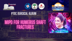 MIPO for Humerus Shaft Fractures - Dr Vidisha Kulkarni