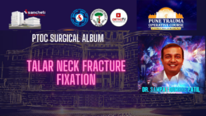 Talar Neck Fracture Fixation - Dr Sampat Dumbre Patil