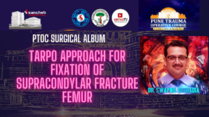 TARPO Approach For Fixation of Supracondylar Fracture Femur by Dr Swapnil Kothad