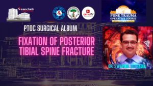 Fixation of Posterior Tibial Spine Fracture - Dr Swapnil Kothadia