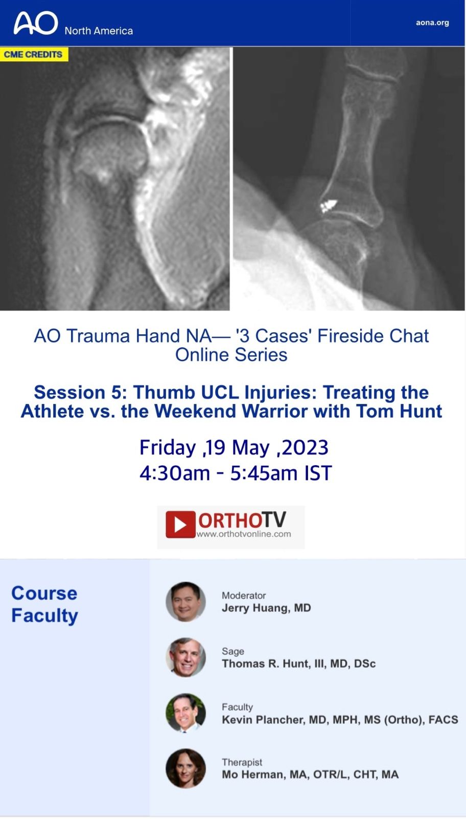 AO Trauma Hand NA- Thumb UCL Injuries: Treating the Athlete vs. the Weekend Warrior with Tom Hunt