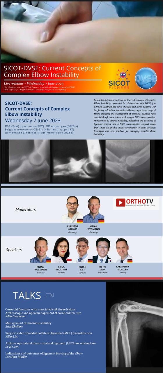 SICOT-DVSE: Current Concepts of Complex Elbow Instability