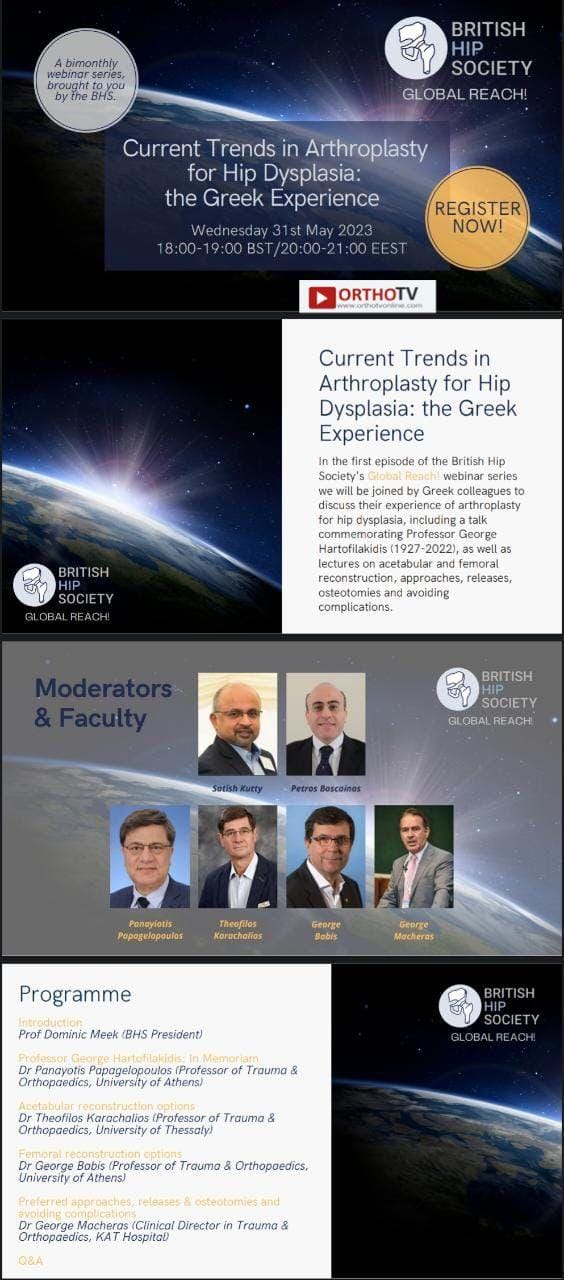 BRITISH HIP SOCIETY GLOBAL REACH - Current Trends in Arthroplasty for Hip Dysplasia: the Greek Experience - BRITISH HIP SOCIETY