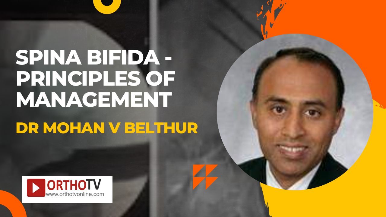 Spina Bifida - Principles Of Management by Dr Mohan V Belthur, MD