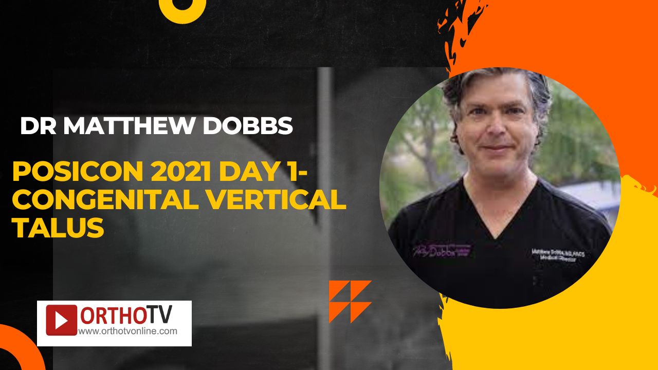 POSICON 2021 DAY 1- congenital vertical talus : Dr Matthew dobbs