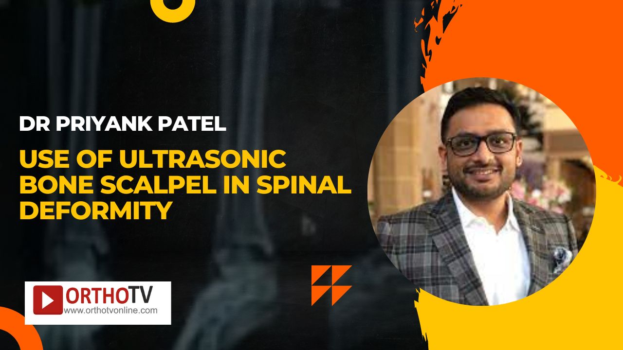 Use of Ultrasonic bone Scalpel in Spinal Deformity... - Dr Priyank Patel