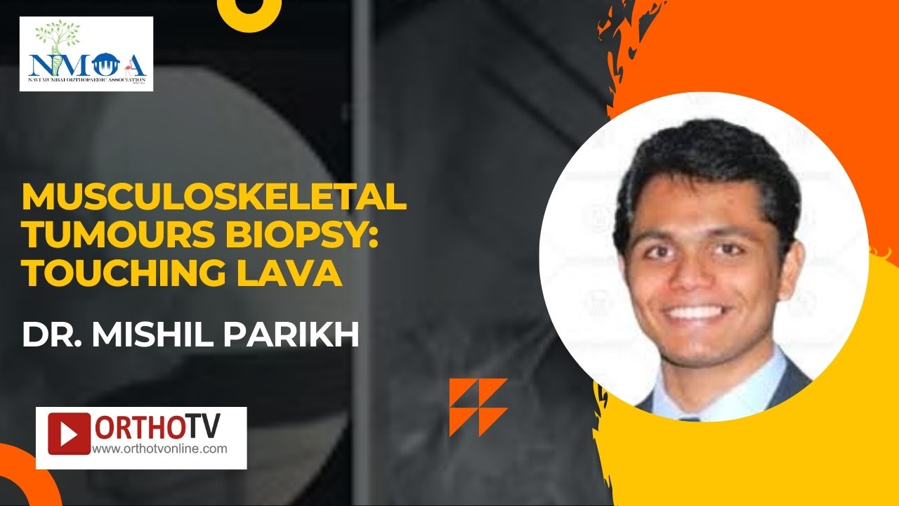 NMOACON 2022 : MUSCULOSKELETAL TUMOURS BIOPSY: TOUCHING LAVA - DR. MISHIL PARIKH