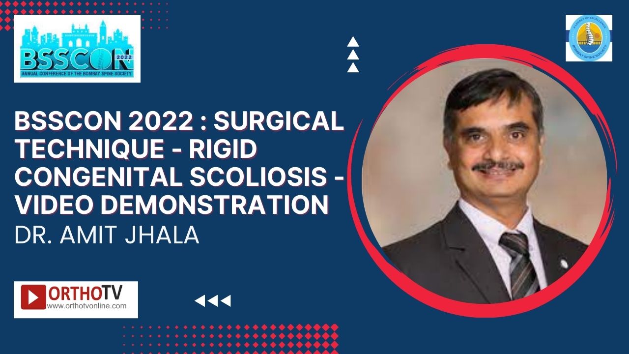 BSSCON 2022 : Surgical Technique - Rigid Congenital Scoliosis - Video Demonstration - Dr. Amit Jhala