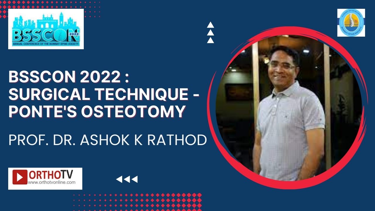 BSSCON 2022 : Surgical Technique - Ponte's Osteotomy - Prof. Dr. Ashok K Rathod