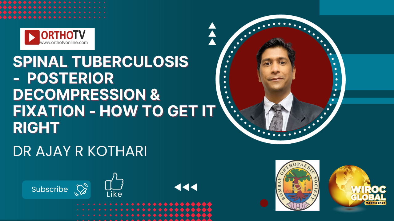 Spinal Tuberculosis -  Posterior Decompression & Fixation - How to get it right - Dr Ajay R Kothari