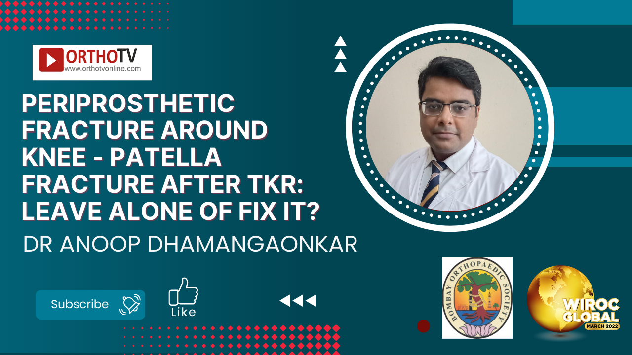 Patella Fracture after TKA: Leave alone of Fix it? - Dr Anoop Dhamangaonkar