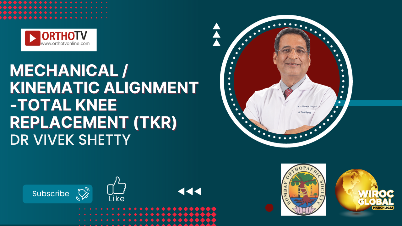 Mechanical / Kinematic Alignment -Total Knee Replacement (TKR) - Dr Vivek Shetty