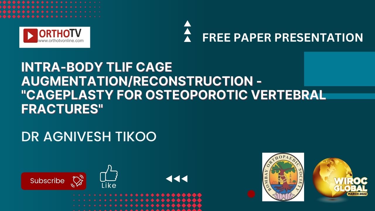 Intra-body TLIF cage Augmentation/Reconstruction - "Cageplasty for Osteoporotic Vertebral Fractures" - Dr Agnivesh Tikoo
