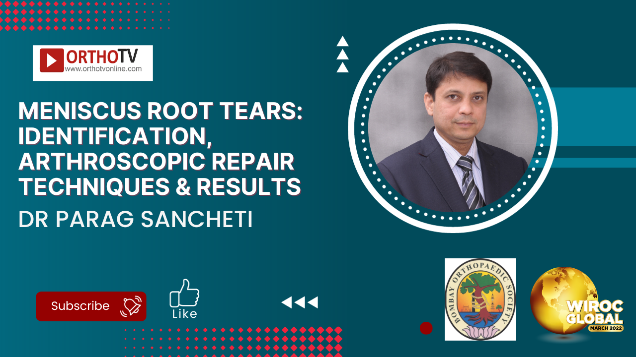 Meniscus Root Tears: Identification, Arthroscopic Repair Techniques & Results  - Dr Parag Sancheti