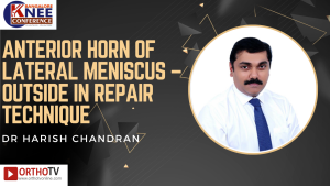 Anterior Horn of Lateral Meniscus – Outside in Repair Technique - DR HARISH CHANDRAN