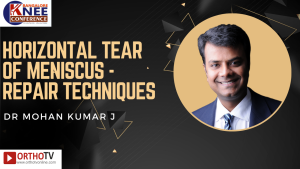 Horizontal Tear of Meniscus -repair Techniques - DR MOHAN KUMAR J