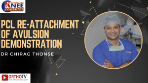 PCL RE-ATTACHMENT OF AVULSION DEMONSTRATION - DR CHIRAG THONSE