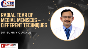 Radial Tear of Medial Meniscus – Different techniques - DR SUNNY GUGALE