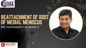 Reattachment of root of medial meniscus - DR YASHWANT KUMAR C
