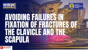 WIROC MAX 2022 - AVOIDING FAILURES IN FIXATION OF FRACTURES OF THE CLAVICLE AND THE SCAPULA