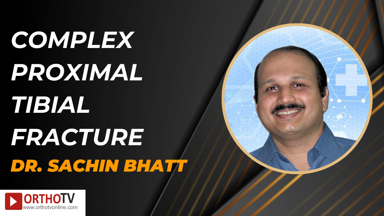 Complex Proximal Tibial Fracture - Dr. Sachin Bhatt